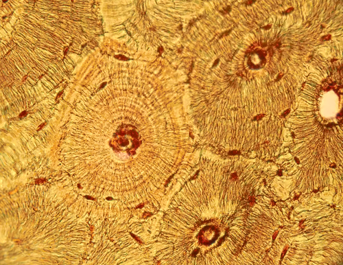Micrographie d’os compact : plusieurs ensembles de lamelles concentriques entourent des canaux centraux.