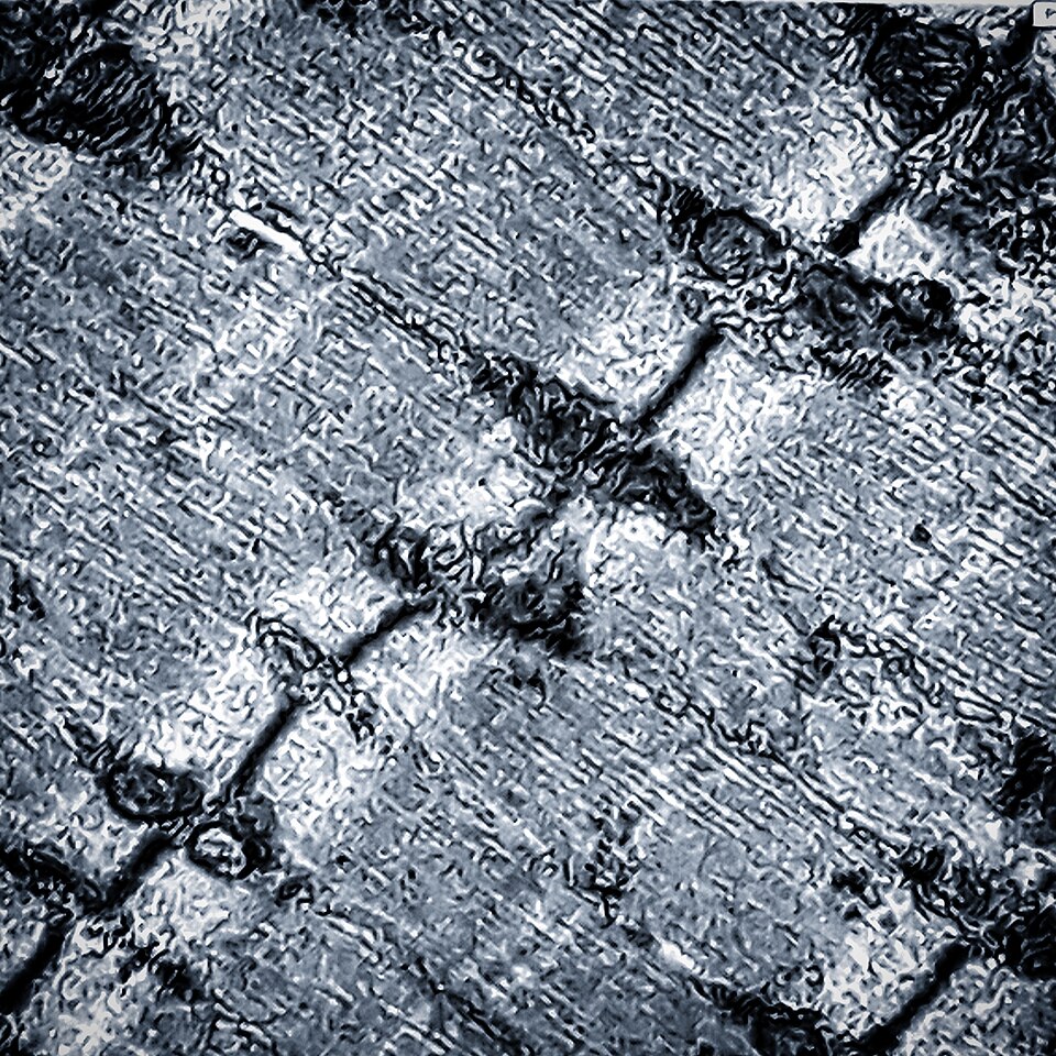 Électronographie d’un muscle : ligne Z sombre en diagonale, organisation striée et profils mitochondriaux de part et d’autre.